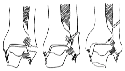 GL Chirurgie 3.2. Weber