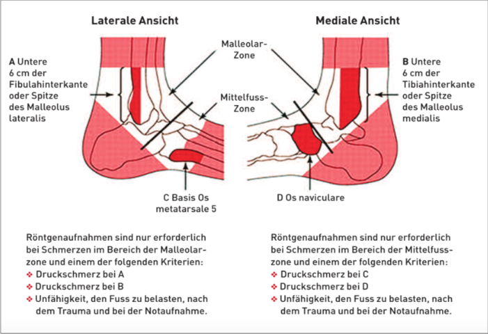 GL Osteoporose Abb